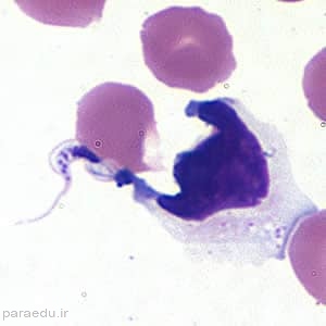 تریپوماستیگوت تریپانوزوما کروزی Trypanosoma cruzi trypomastigotes