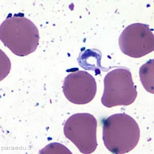  تریپوماستیگوت تریپانوزوما کروزی Trypanosoma cruzi trypomastigotes