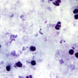 تریپوماستیگوت تریپانوزوما کروزی Trypanosoma cruzi trypomastigotes