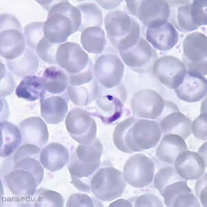 تریپوماستیگوت تریپانوزوما کروزی Trypanosoma cruzi trypomastigotes