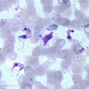 تریپوماستیگوت تریپانوزوما کروزی Trypanosoma cruzi trypomastigotes