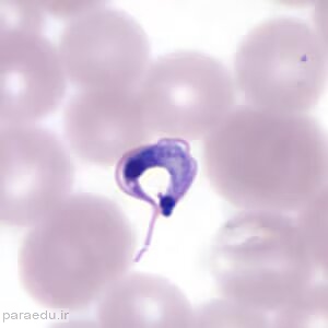 تریپوماستیگوت تریپانوزوما کروزی Trypanosoma cruzi trypomastigotes