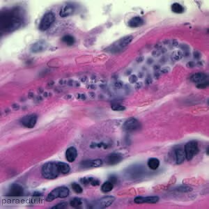 آمستیگوت تریپانوزوما کروزی Trypanosoma cruzi amastigotes