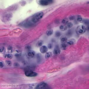 آمستیگوت تریپانوزوما کروزی Trypanosoma cruzi amastigotes