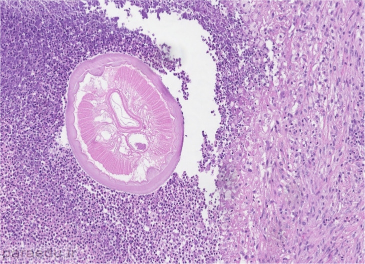 Dirofilaria spp- Iranian Journal of Parasitology