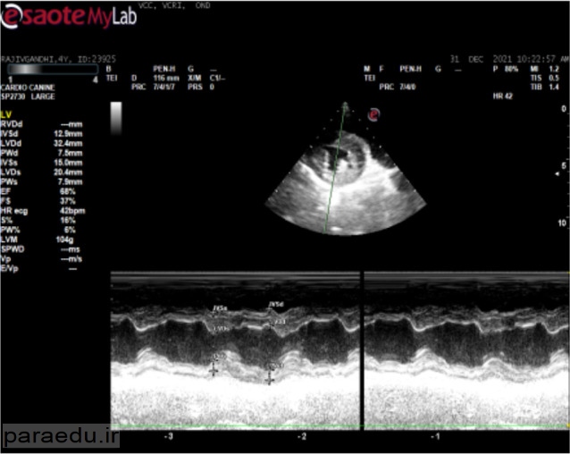 M Mode Echocardiography - Right parasternal short axis- ventricular hypertrophy  - Iranian Journal of Parasitology